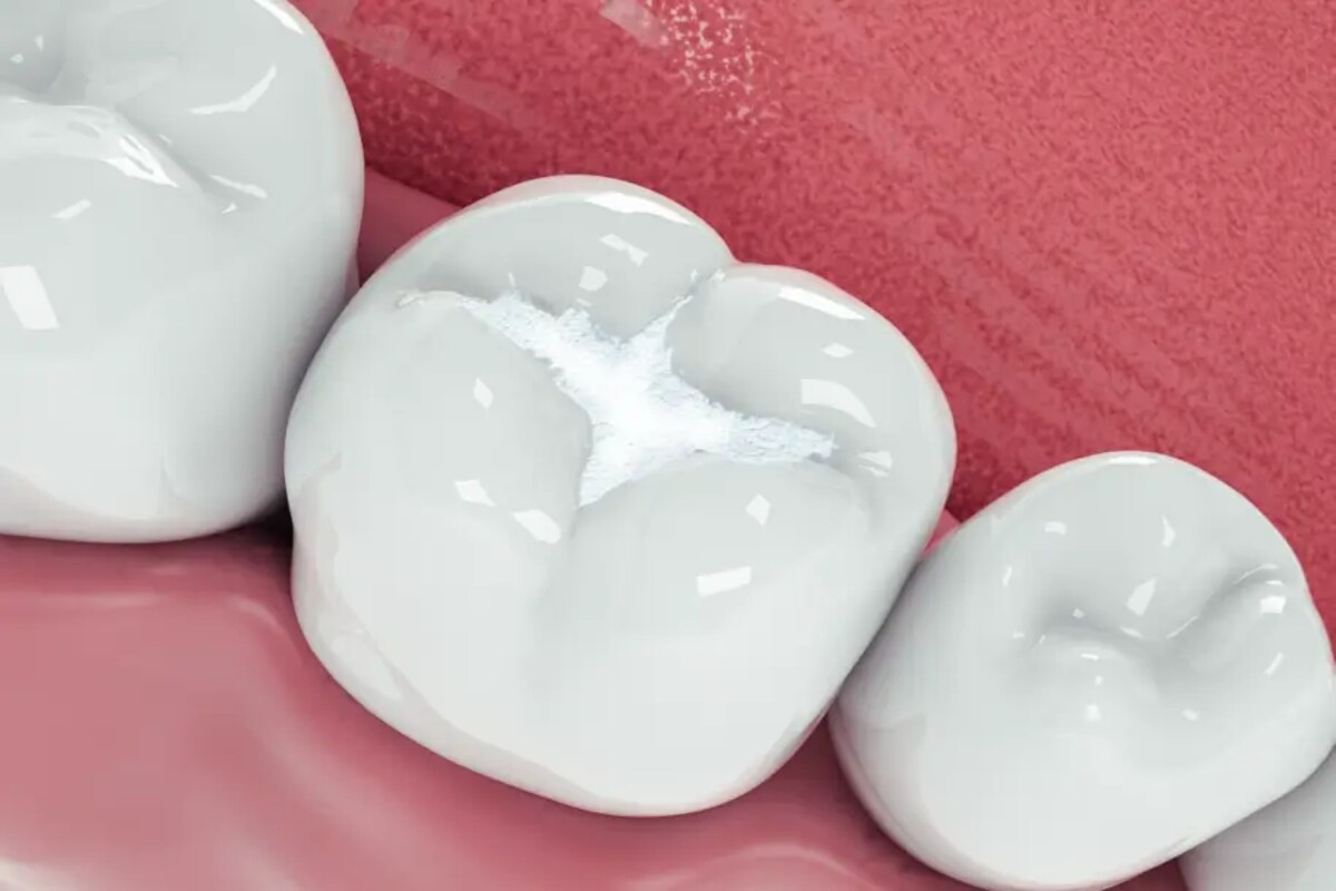 do enamel repairing toothpastes actually work
