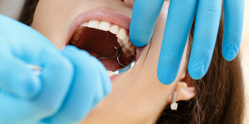 everything should know about wisdom teeth removal