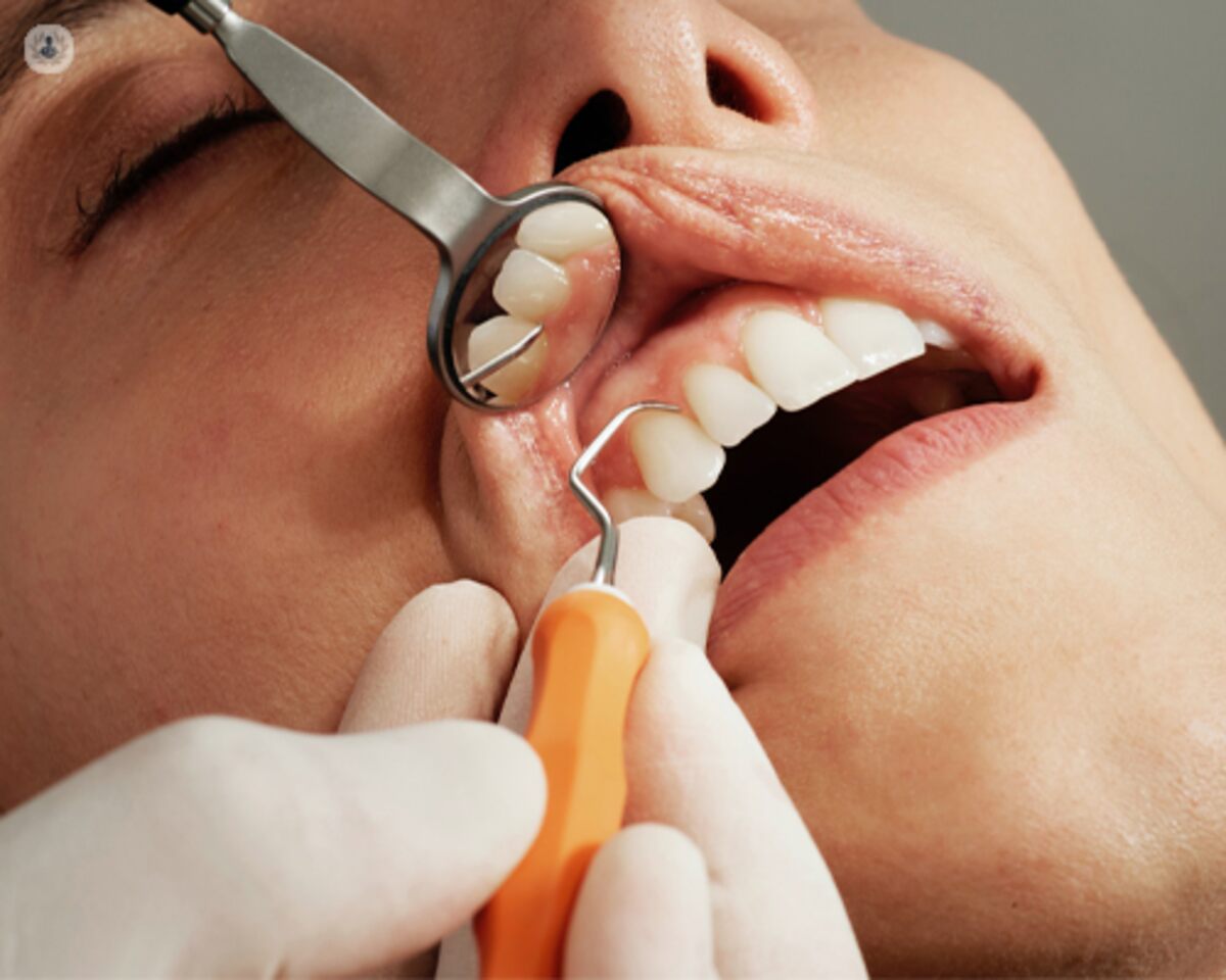 what to know about tooth abscess